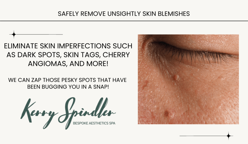 Removal of dark spots, skin tags and more