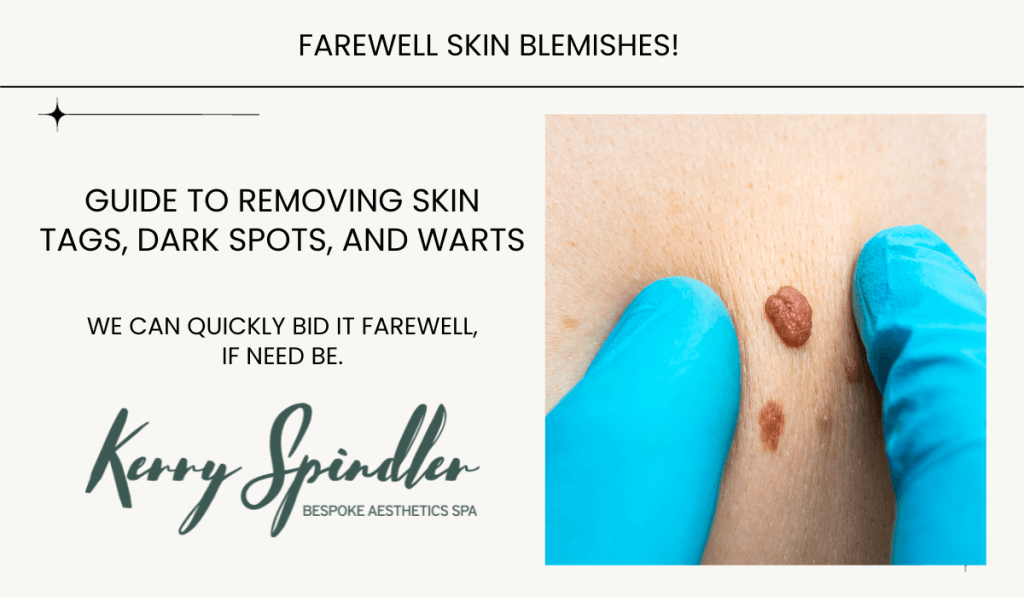 Safely Remove Skin Tags & Blemishes Easily