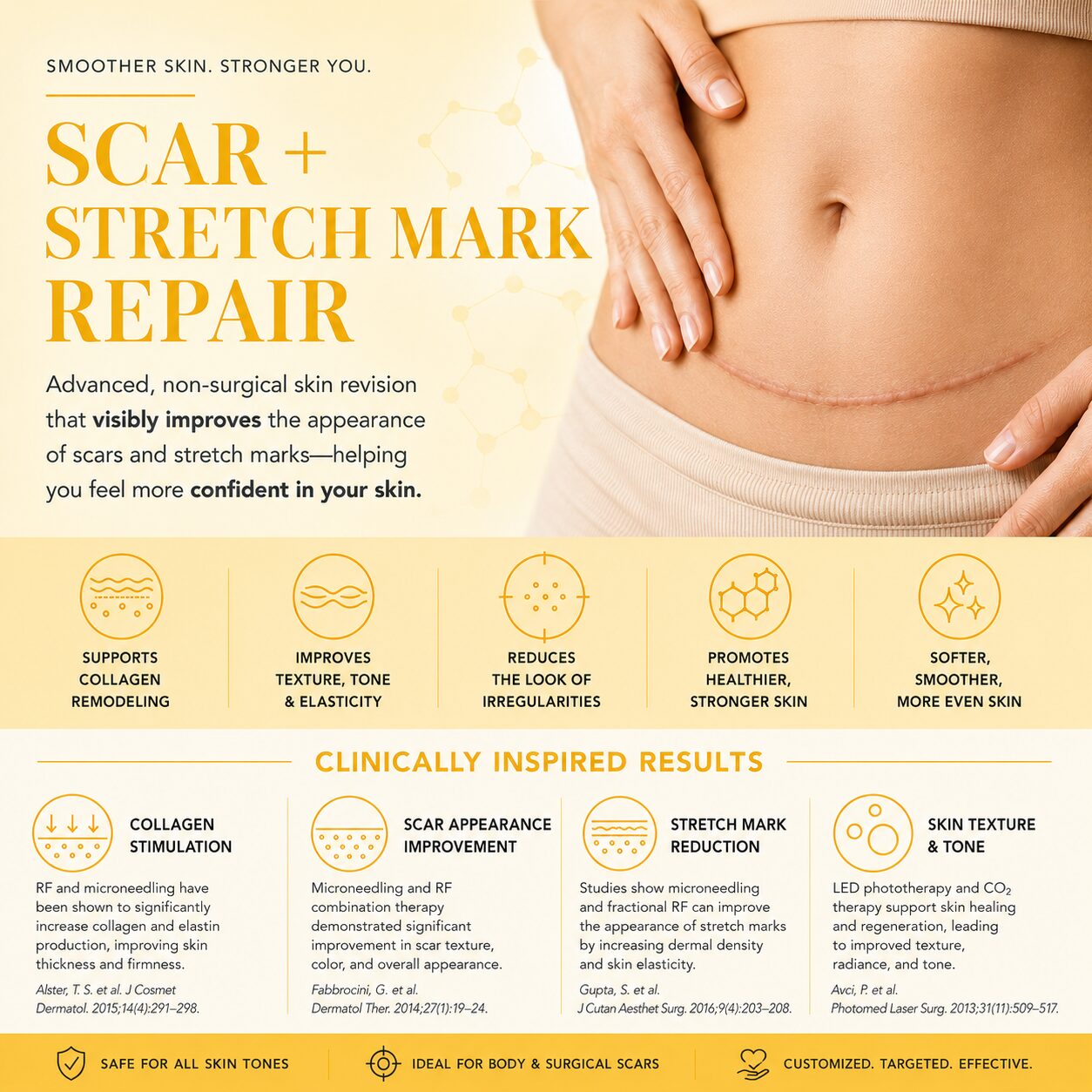 Scar + Stretch Mark Repair near Boston. Post partum scars, tunny tuck, surgical scars kerry spindler