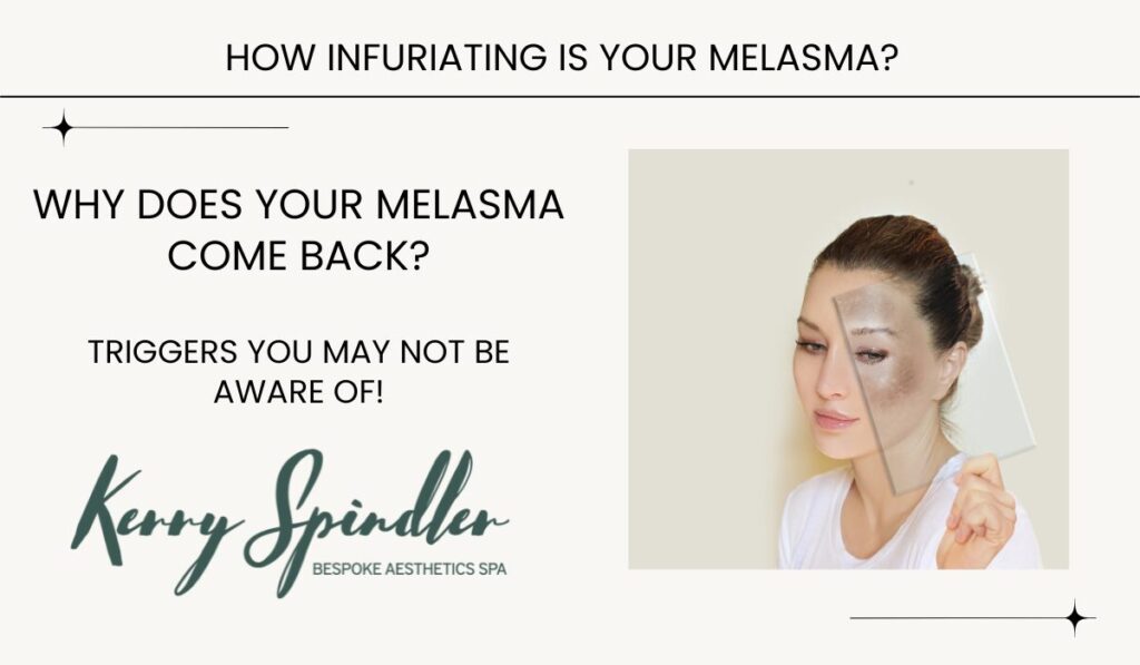 Why Does My Melasma Come Back? Triggers and Solutions