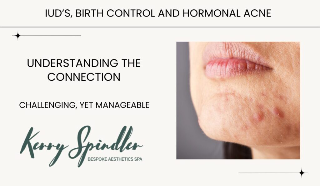 IUD and Hormonal Acne: Understanding the Connection