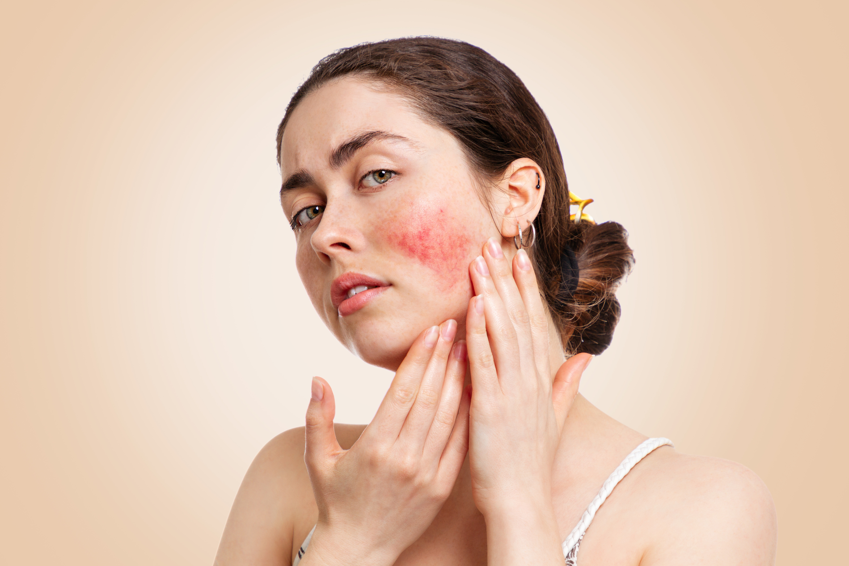 Targeted hormonal skin treatments in Boston for acne, melasma and hormone-related skin changes.