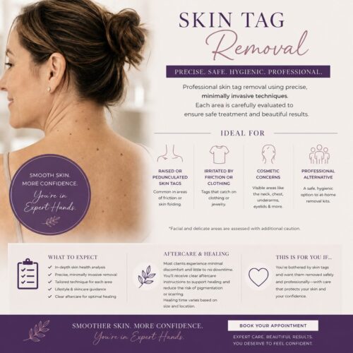skin tag removal near boston