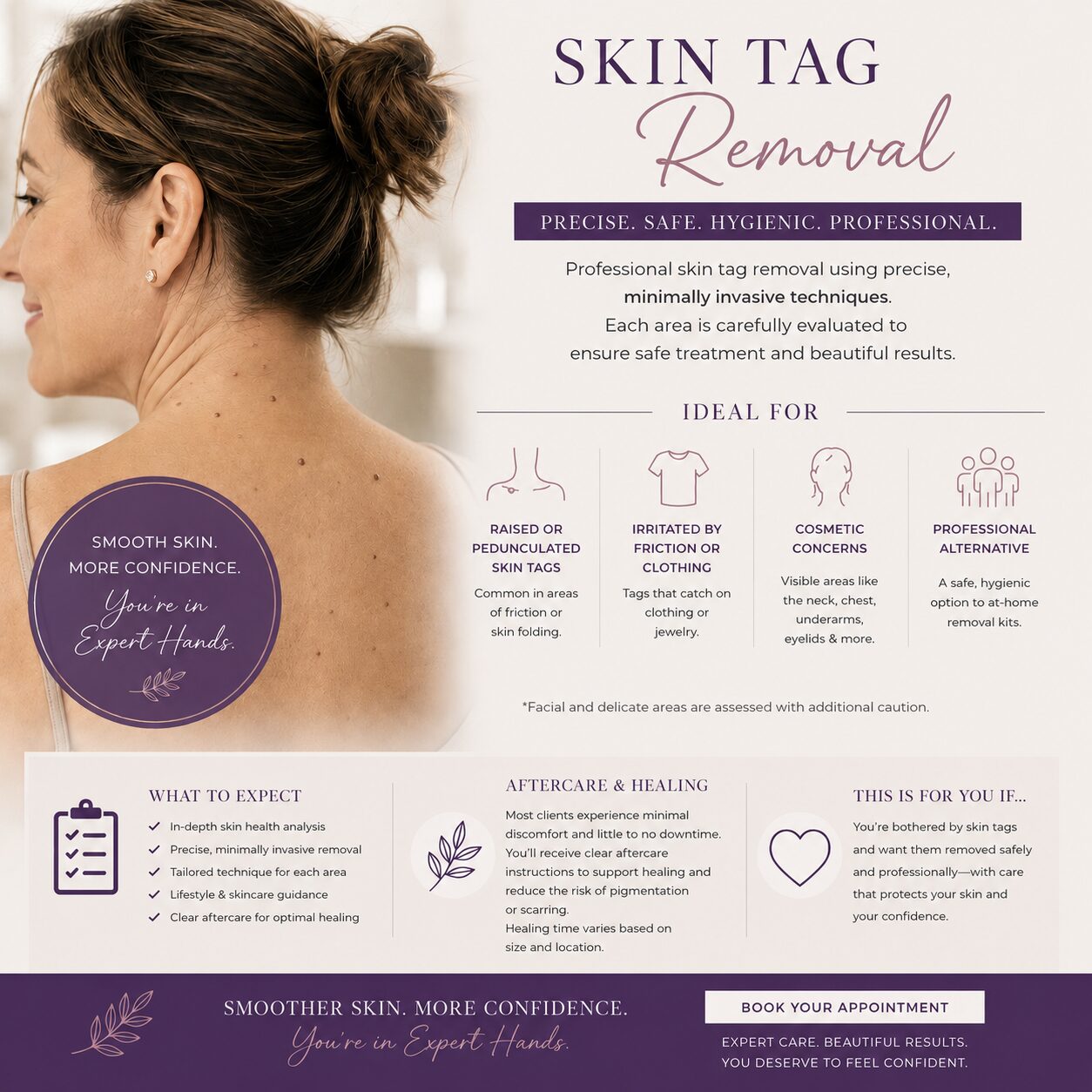 skin tag removal near boston