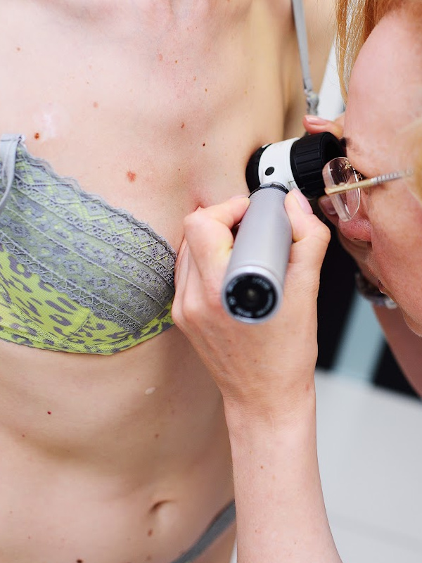 kerry spindler melanoma diagnosis